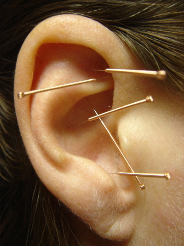 ear acupuncture points